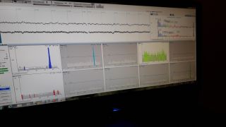 Gabinet logopedyczny, neuroterapia EEG Biofeedback Piotrków Trybunalski Monika Dzienniak, terapia wad wymowy i zaburzeń mowy Gabinet logopedyczny, neuroterapia EEG Biofeedback Piotrków Trybunalski Monika Dzienniak, terapia wad wymowy i zaburzeń mowy